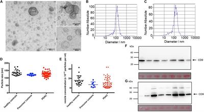 Extracellular Vesicle-Based Detection of Pancreatic Cancer